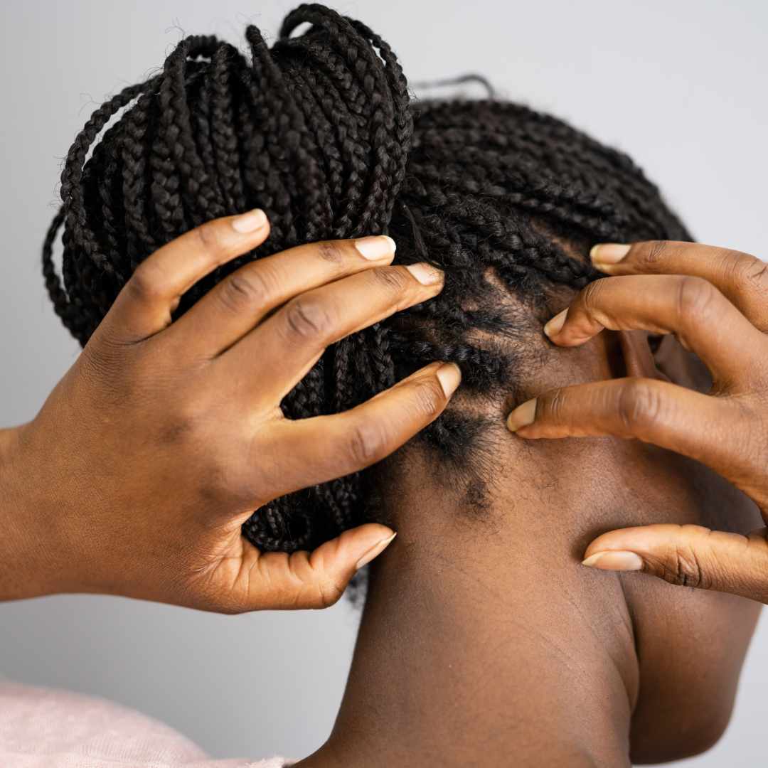 Shampoo til kløende hovedbund